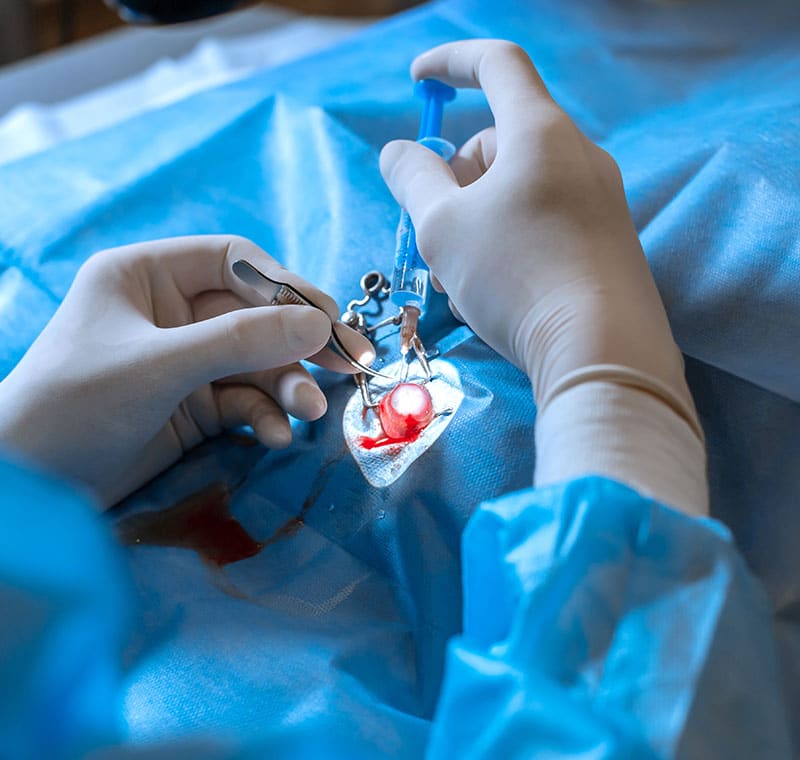 A surgeon’s gloved hands perform a precise operation, using surgical tools on a patient’s chest. Blue surgical drapes and equipment surround the incision area, representing expert Veterinary Surgery Services in Rockaway NJ.